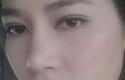 ภาพหลุด “ปู“ สภาพถูกสามีซ้อม