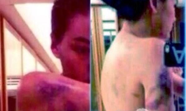 หลุดว่อน! ภาพคล้ายนางเอกสาวถูกซ้อมช้ำทั้งตัว